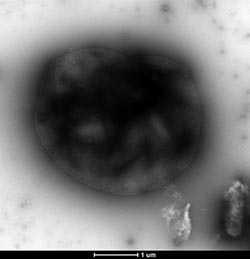 Micrograph of a synthetic bacterium that manufactures the chemical needed to capture electrons.