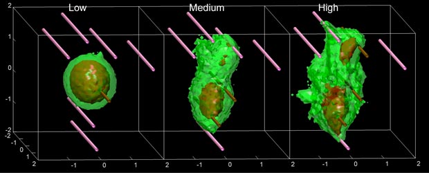 Effect on chemotaxis on tumor progression.